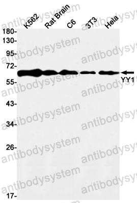 Anti-YY1 Antibody (R1S83)