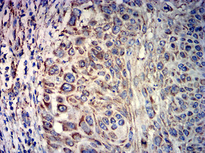 Immunohistochemical for Anti-ATP5F1A Antibody (R3G80) ?>