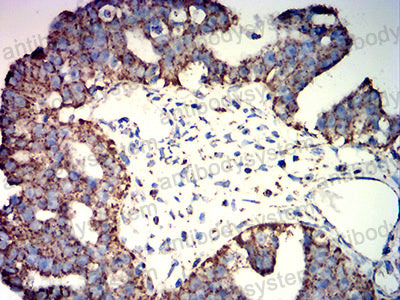 Immunohistochemical for Anti-ATP5F1A Antibody (R3G80) ?>