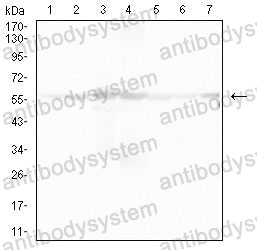 Western blot for Anti-ATP5F1A Antibody (R3G80) ?>