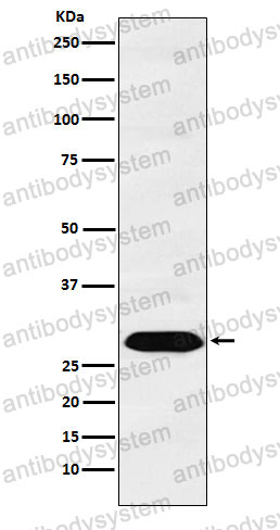 Anti-PSMA1 Antibody (R1S86)