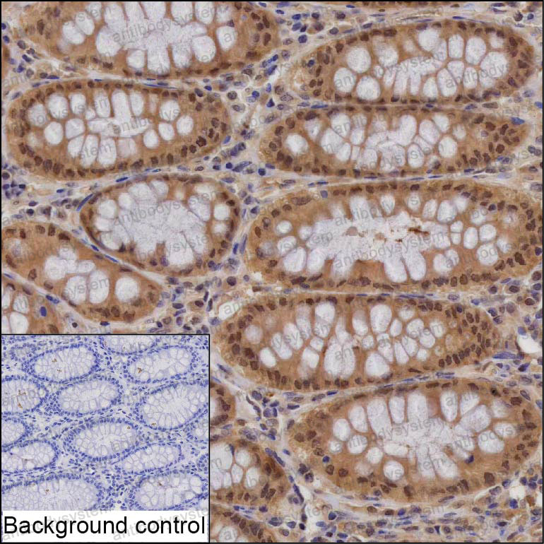 Immunohistochemical for Anti-PSMA1 Antibody (R3G84) ?>