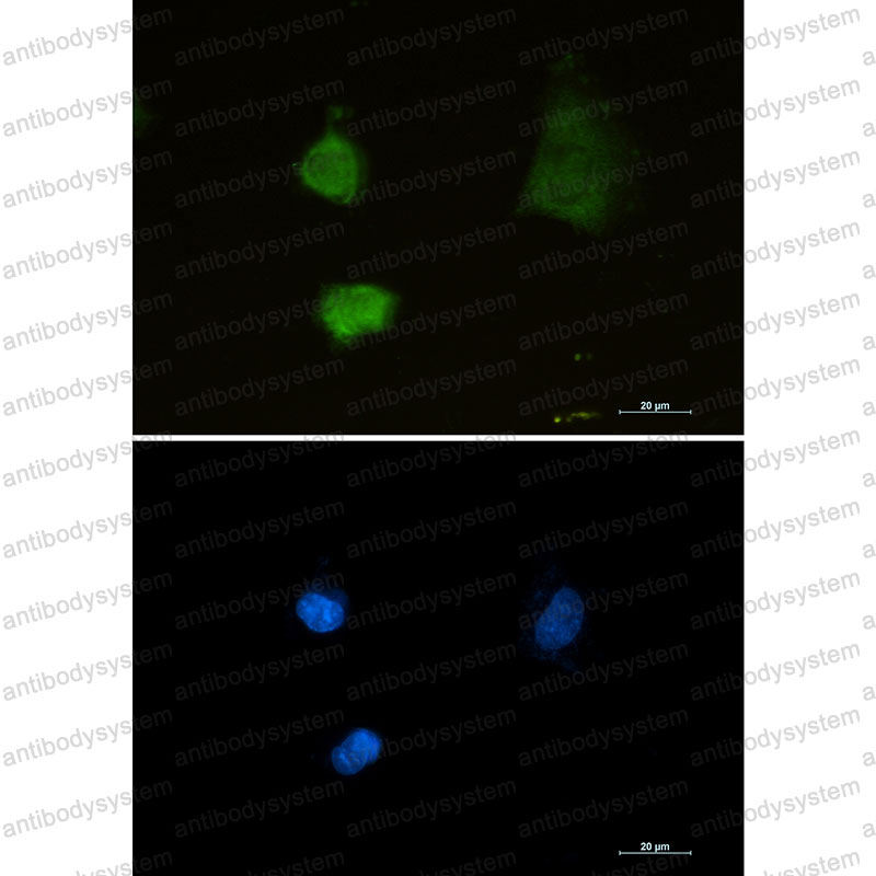 Anti-PSMA2 Antibody (R1S88)