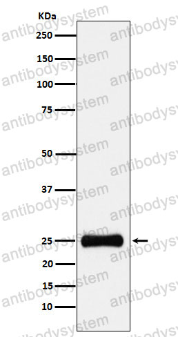 Anti-PSMA2 Antibody (R1S87)