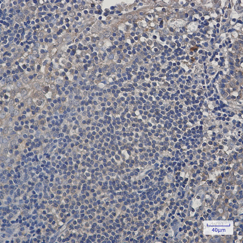 Anti-PSMA4 Antibody (R1S90)