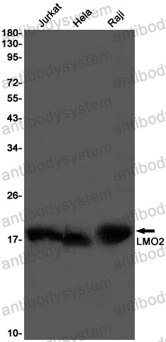 Anti-LMO2 Antibody (R1S91)