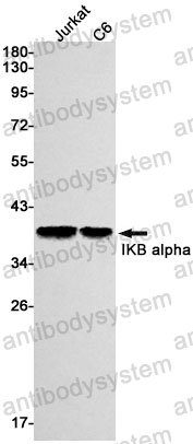 Anti-NFKBIA Antibody (R1S97)