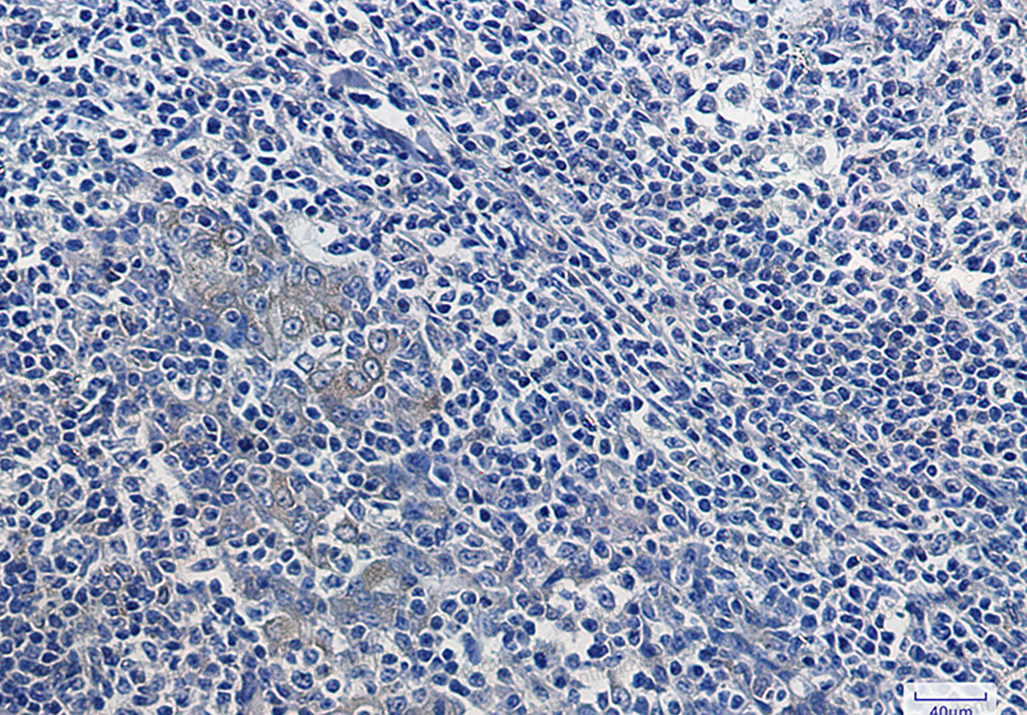 Anti-NFKBIA Antibody (R1S96)
