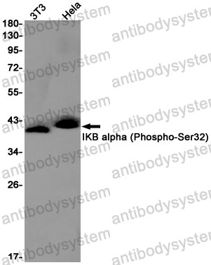 Anti-Phospho-NFKBIA/IKB alpha (Ser32) Antibody (R1S94)