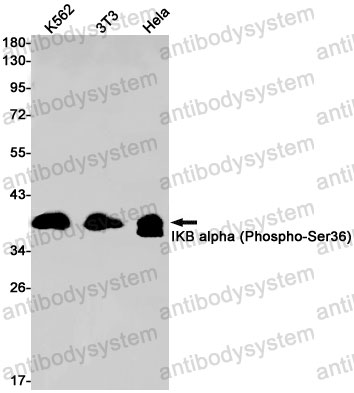 Anti-Phospho-NFKBIA/IKB alpha (Ser36) Antibody (R1S95)