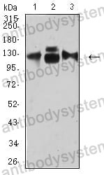 Western blot for Anti-CD49c/ITGA3 Antibody (R3G95) ?>