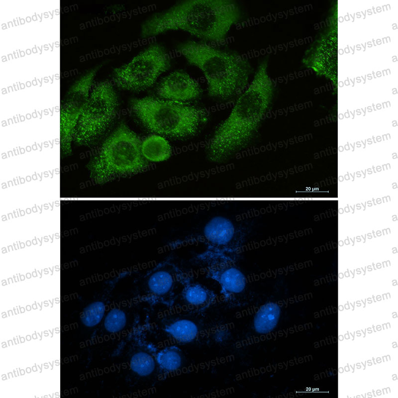 Anti-MSN Antibody (R1T02)