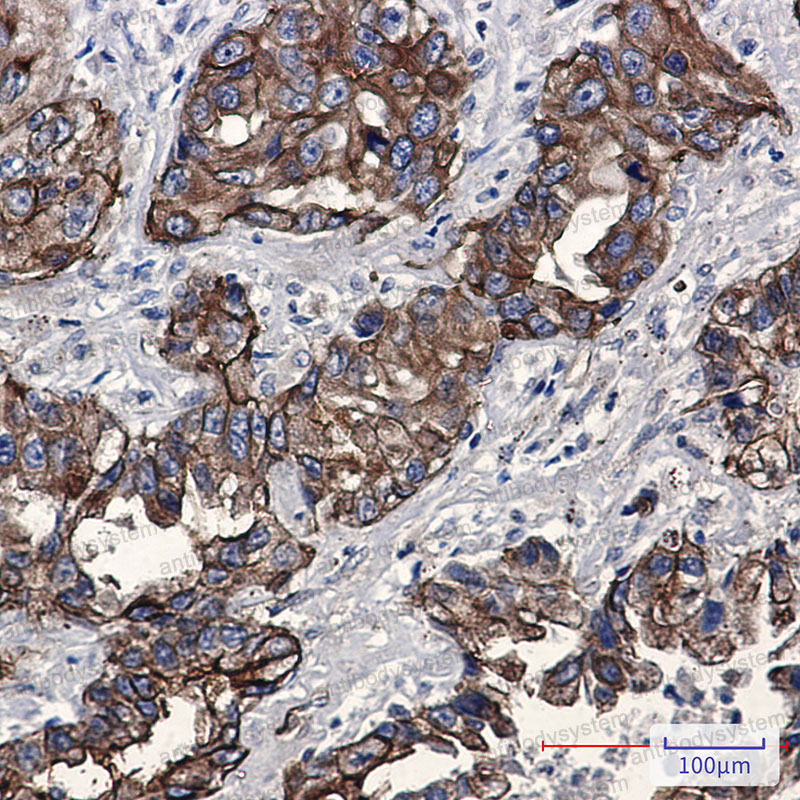 Anti-Phospho-MSN/Moesin (Thr558) Antibody (R1S99)