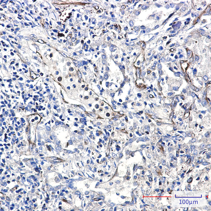 Anti-MSN Antibody (R1T01)