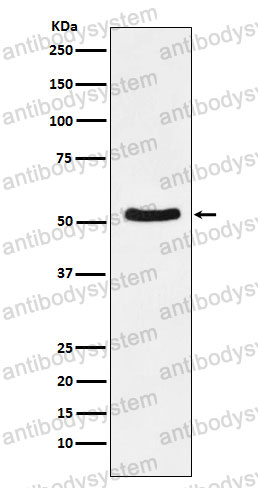 Anti-DDX6 Antibody (R1T03)