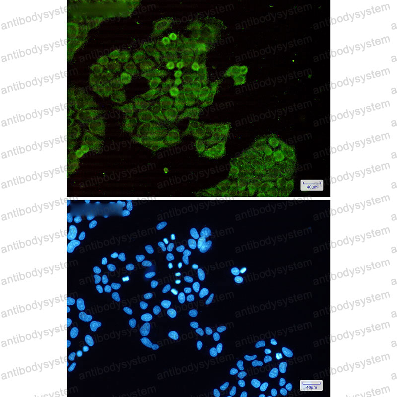 Anti-DNMT1 Antibody (R1T04)