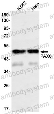 Anti-PAX6 Antibody (R1T05)