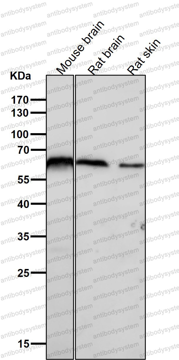 Anti-U2AF2 Antibody (R1T06)