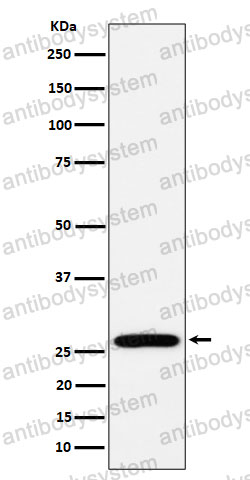 Anti-RPL13 Antibody (R1T07)