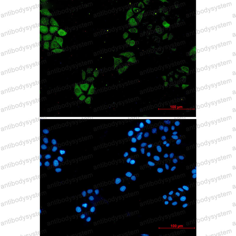 Anti-S100A4 Antibody (R1T08)