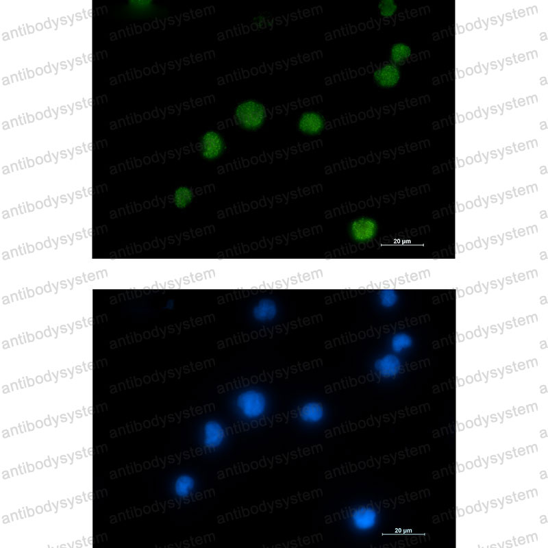 Anti-HMGB2 Antibody (R1T10)