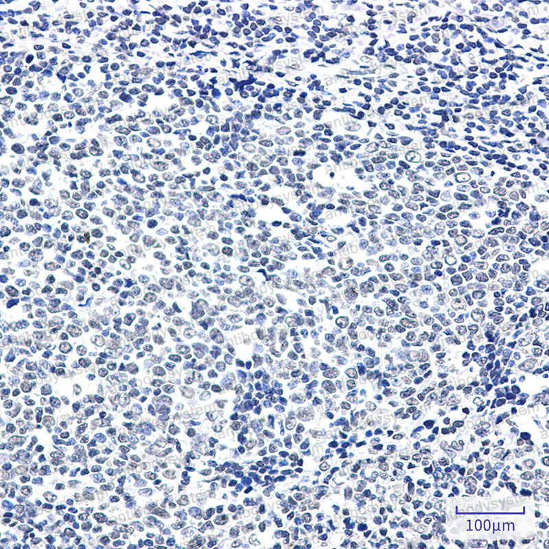 Anti-PTBP1 Antibody (R1T12)