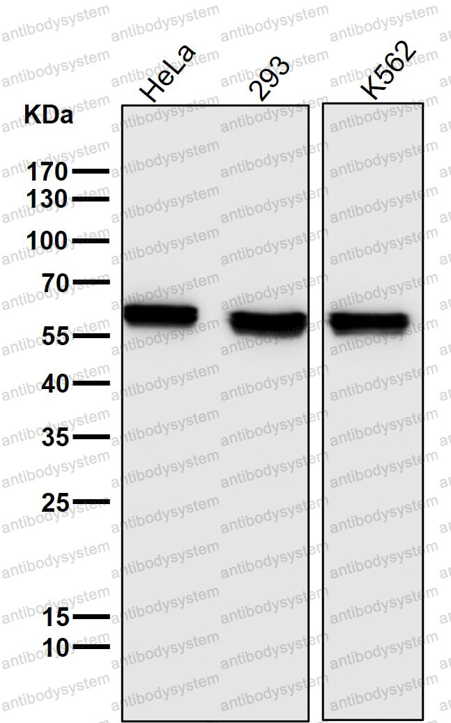 Anti-PTBP1 Antibody (R1T11)