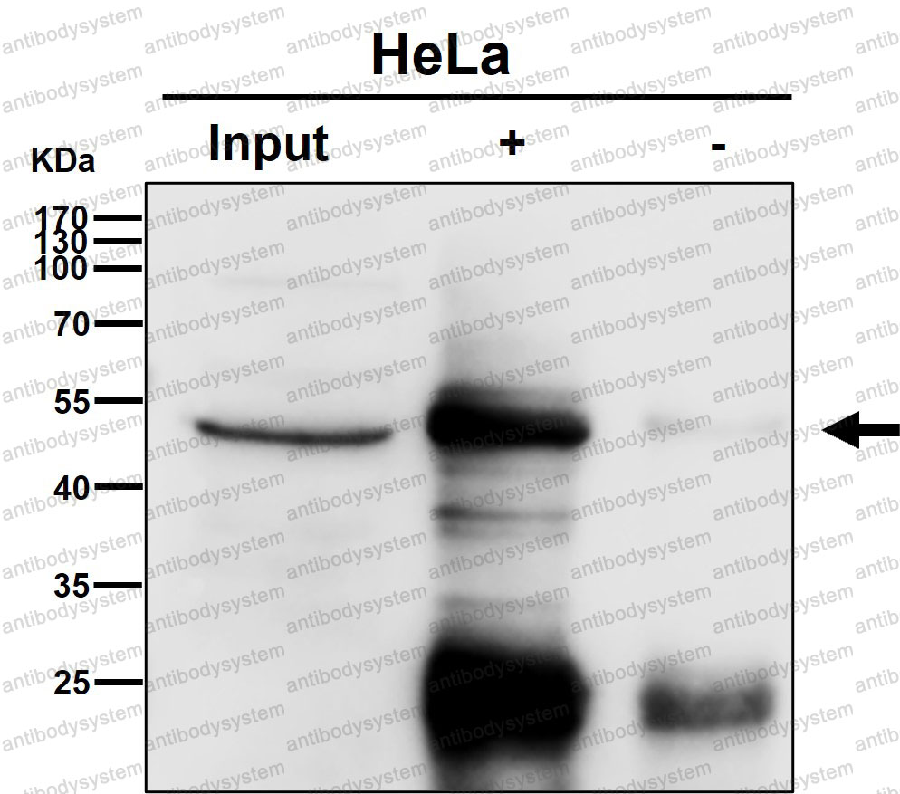 Anti-EEF1G Antibody (R1T13)