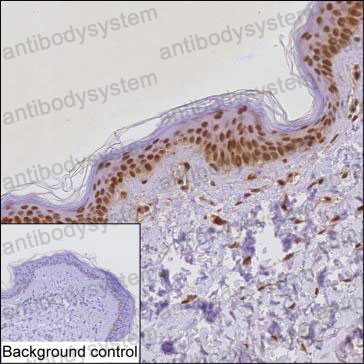 Immunohistochemical for Anti-ZFP36 Antibody (R3H15) ?>