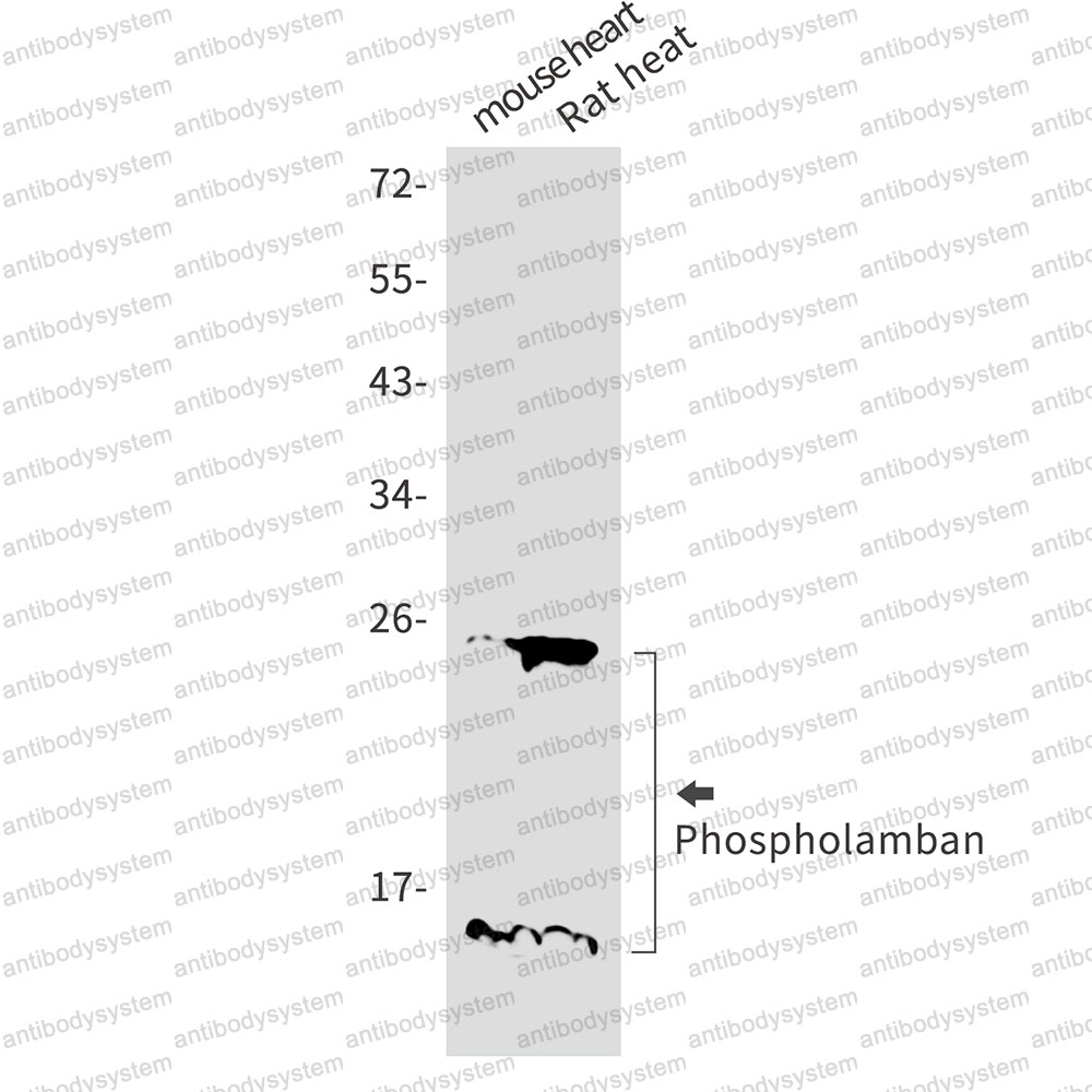 Anti-PLN Antibody (R1T16)