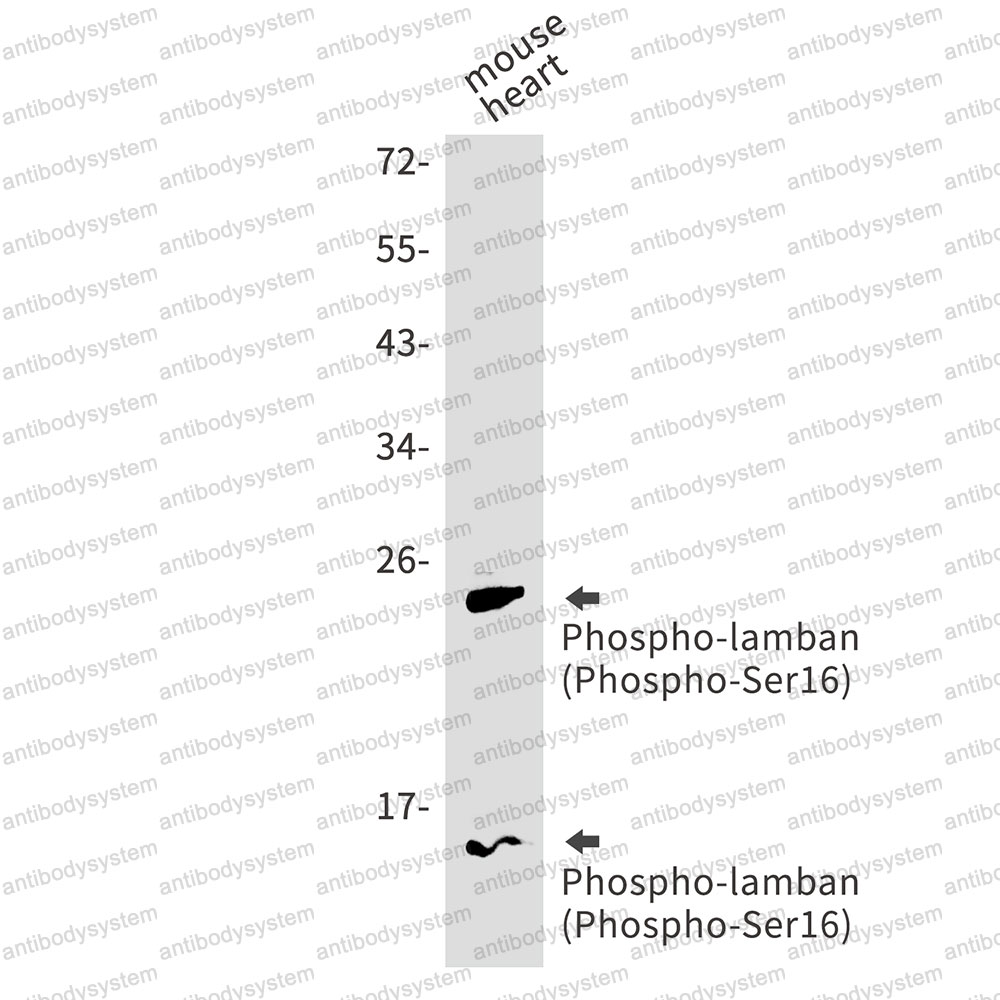 Anti-Phospho-PLN (Ser16) Antibody (R1T15)