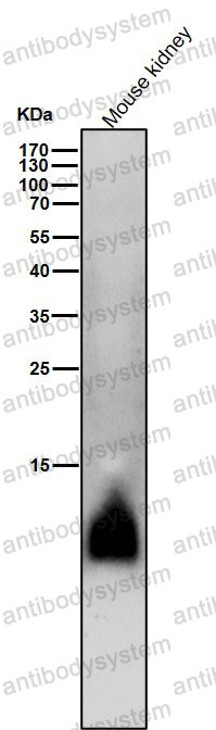 Anti-Phospho-PLN (S16) Antibody (R1T14)