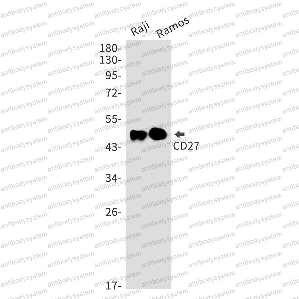 Anti-CD27 Antibody (R1T17)