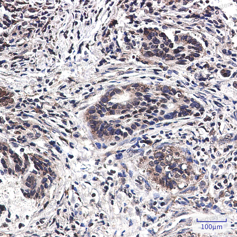 Anti-MST1 Antibody (R1T19)
