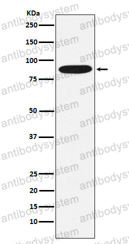 Anti-MST1 Antibody (R1T18)