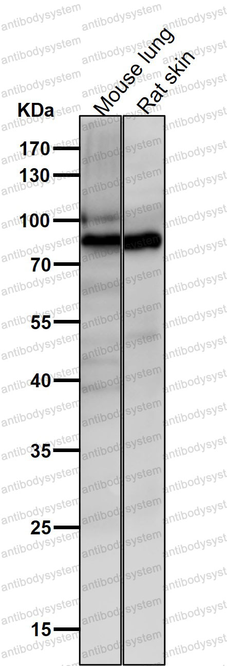 Western blot for Anti-ACVR2A/ACTR-IIA Antibody (R1T20) ?>