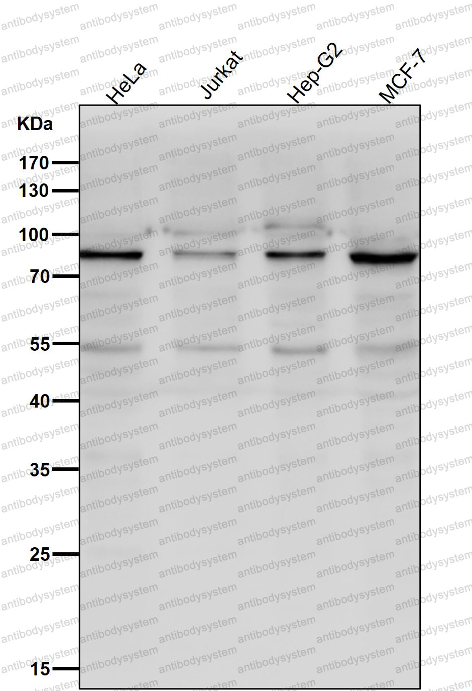 Western blot for Anti-ACVR2A/ACTR-IIA Antibody (R1T20) ?>