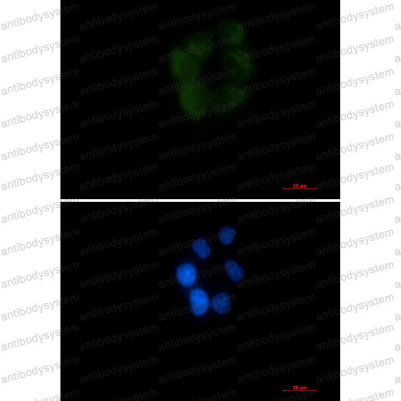 Anti-AK4 Antibody (R1T22)