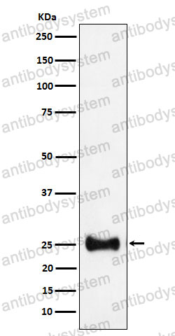 Anti-AK4 Antibody (R1T21)