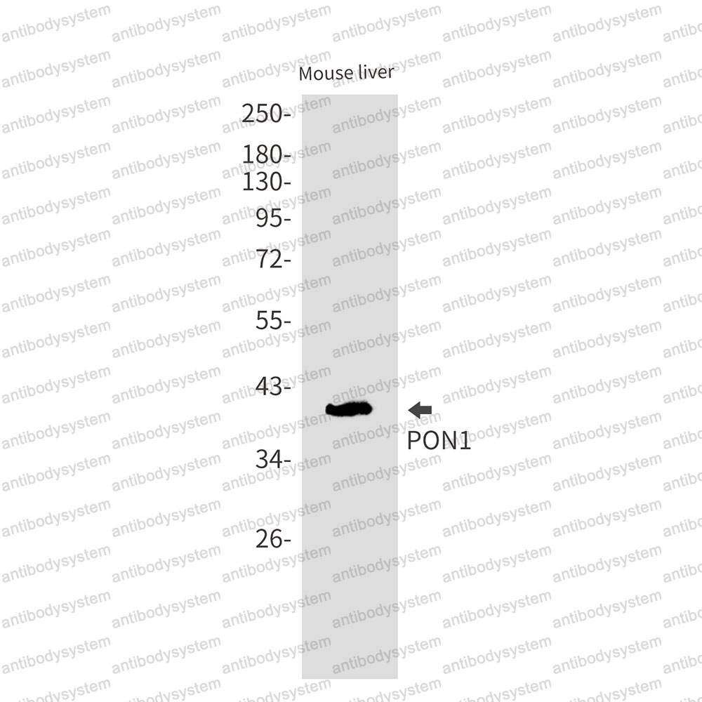Anti-PON1 Antibody (R1T23)