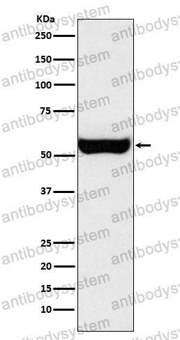 Anti-MAOB Antibody (R1T24)