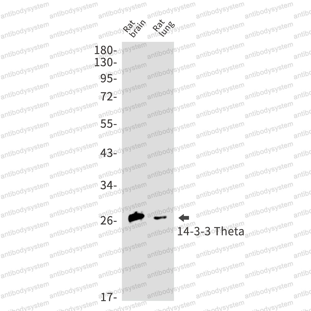 Anti-YWHAQ Antibody (R1T25)