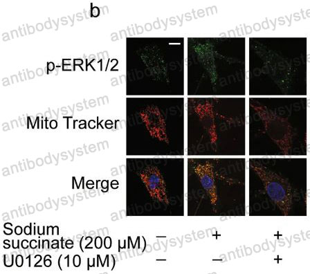 Anti-Phospho-Erk1 (T202/Y204) + Erk2 (T185/Y187) Antibody (R1B13)