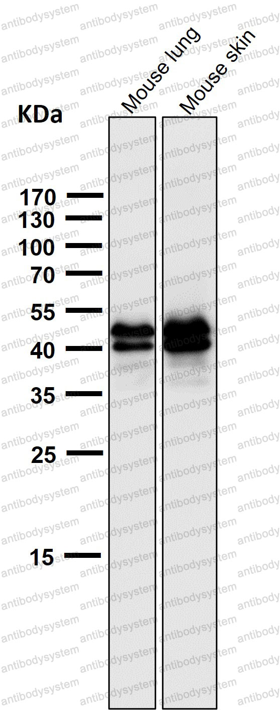 Anti-Phospho-ERK1 (T202) + ERK2 (T185) Antibody (R1T26)
