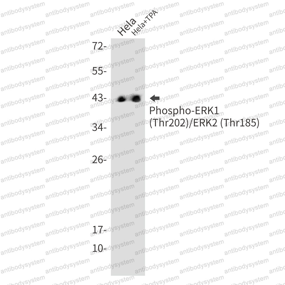 Anti-Phospho-ERK1/2 (Thr202/Thr185) Antibody (R1T27)