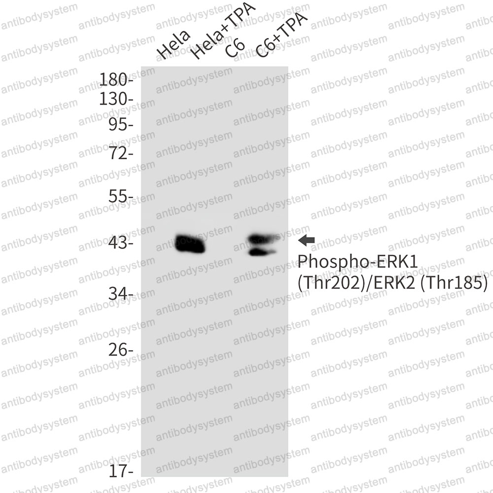 Anti-Phospho-ERK1/2 (Thr202/Thr185) Antibody (R1T28)