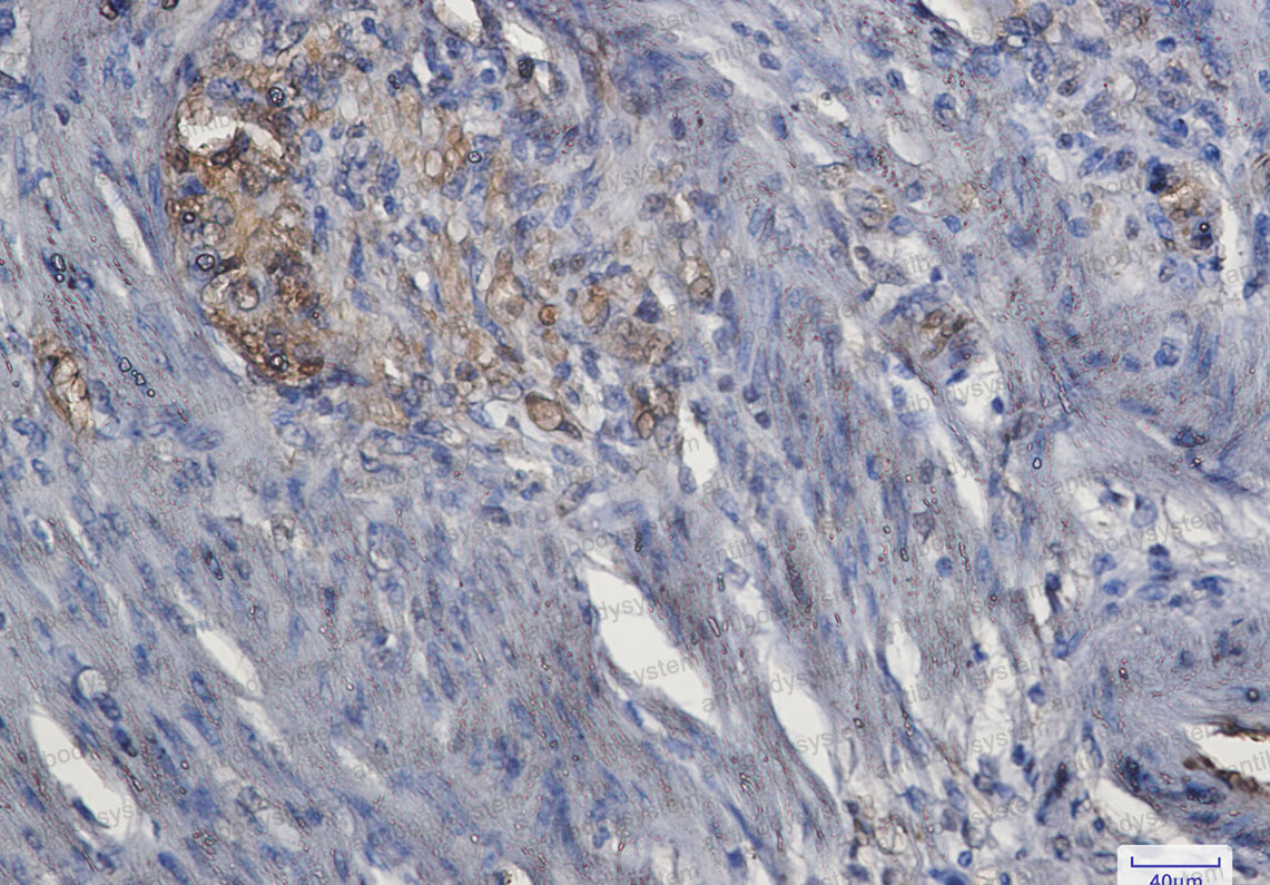 Anti-MAPK3 Antibody (R1T31)