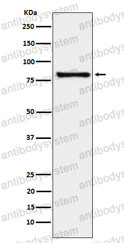 Anti-MARK3 Antibody (R1T32)