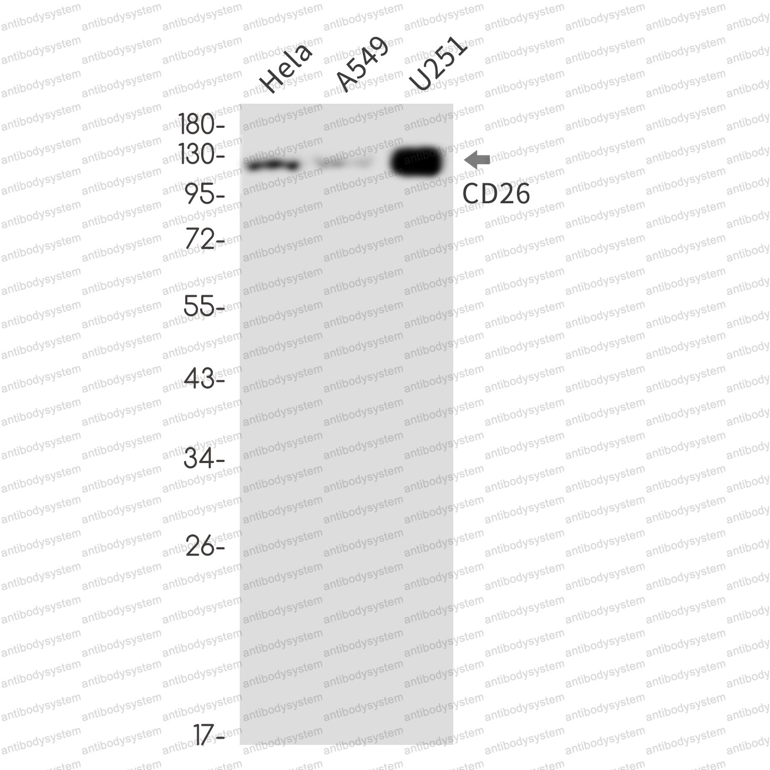 Anti-CD26/DPP4 Antibody (R1T34)