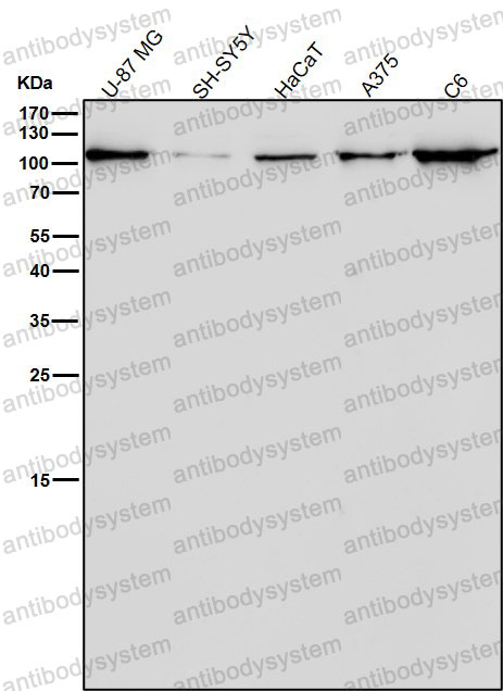 Anti-CD26/DPP4 Antibody (R1T33)
